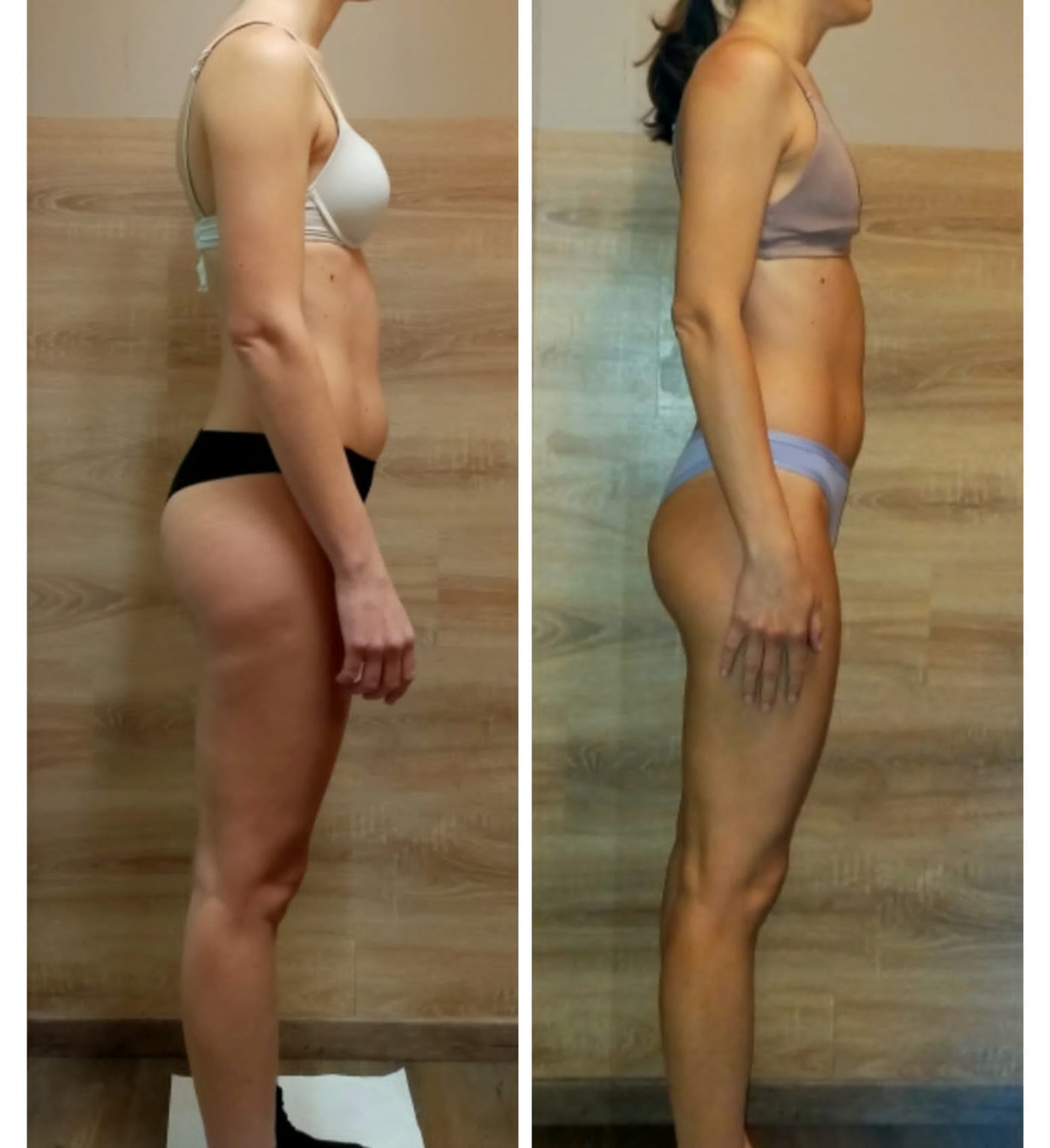 Confronto prima e dopo il trattamento osteoplastico