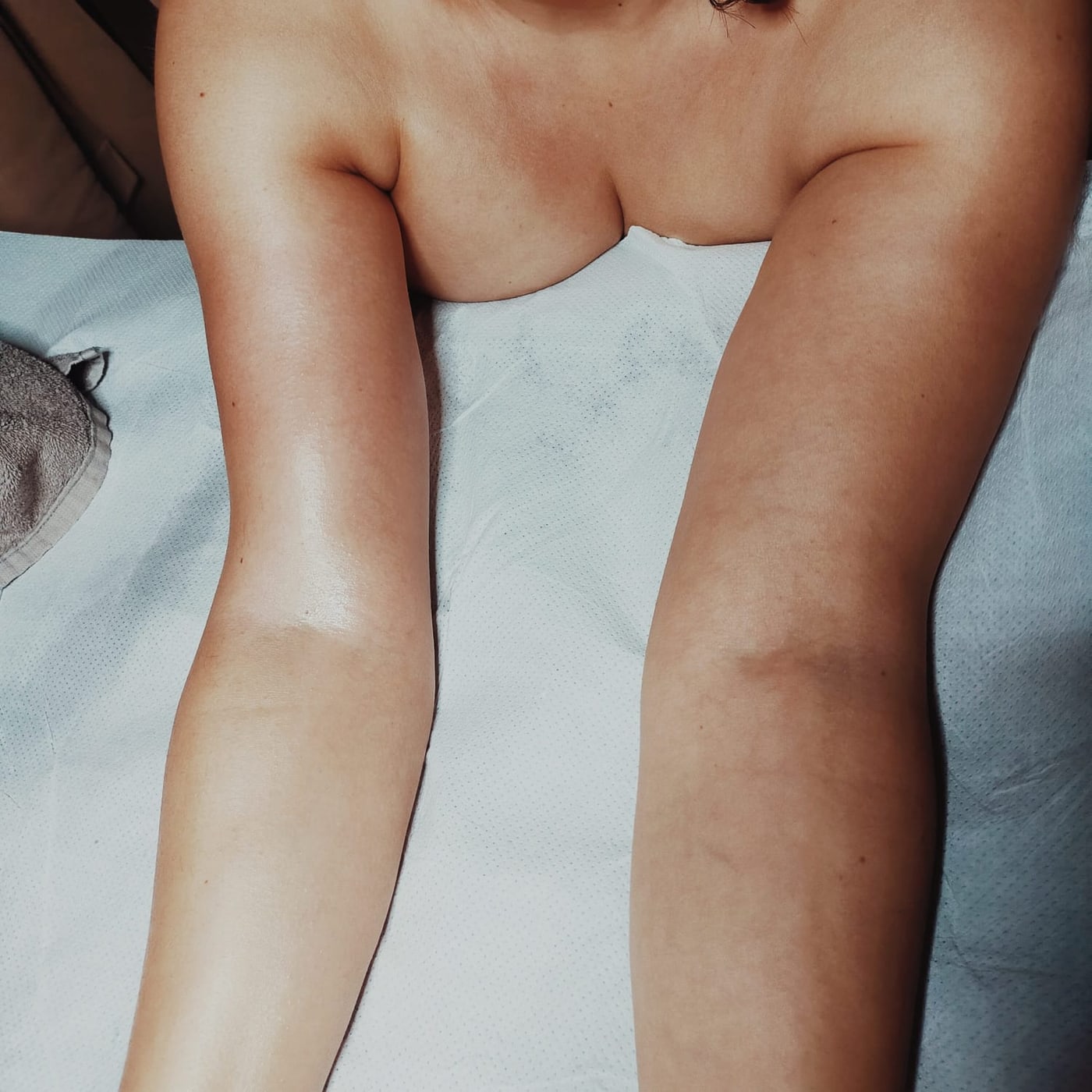 Confronto prima e dopo il trattamento osteoplastico