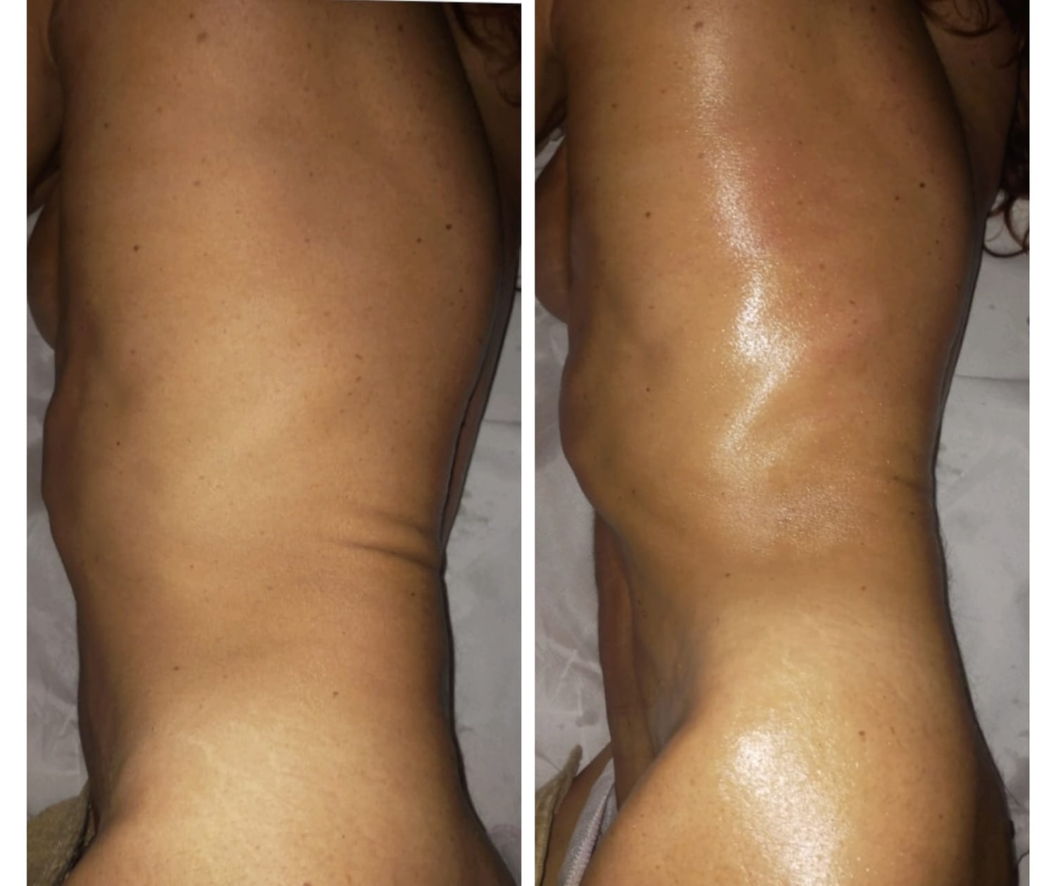 Confronto prima e dopo il trattamento osteoplastico